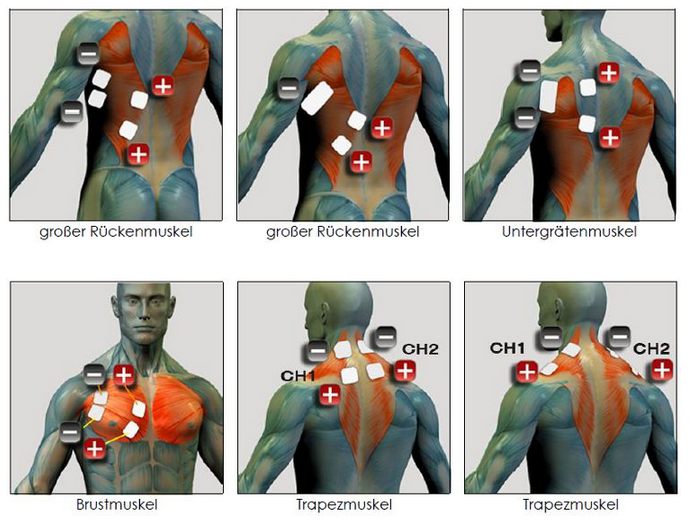 Elektroden Positionen F R Ems Und Mikrostrom Anwendungen Cardiovibe