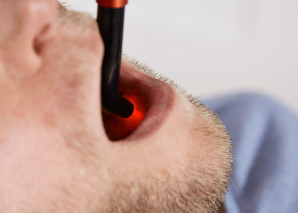 dental-laser-wundheilung-MhQr