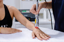 highpower-laserbehandlung-hand