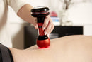 lasertherapie-narbengewebe